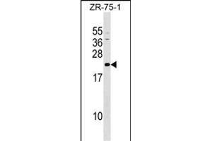 GRPEL1 Antibody (Center) (ABIN1537772 and ABIN2849483) western blot analysis in ZR-75-1 cell line lysates (35 μg/lane). (GRPEL1 anticorps  (AA 116-142))