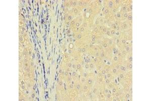 Immunohistochemistry of paraffin-embedded human liver tissue using ABIN7172006 at dilution of 1:100 (TXNDC8 anticorps  (AA 1-115))