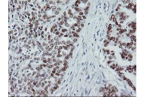 Image no. 2 for anti-Tumor Protein P53 (TP53) antibody (ABIN1499973) (p53 anticorps)