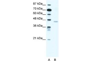 WB Suggested Anti-CNP Antibody Titration:  1. (Cnpase anticorps  (N-Term))