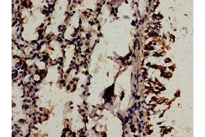 Immunocytochemistry analysis of human lung tissue using ABIN7175842 at dilution of 1:100