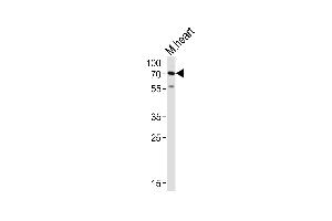 HAS2 anticorps  (AA 138-166)