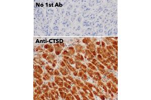 Immunohistochemistry (IHC) image for anti-Cathepsin D (CTSD) (C-Term) antibody (ABIN6254162) (Cathepsin D anticorps  (C-Term))