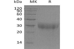 Placenta Growth Factor (PGF) (Active) protein (His tag)