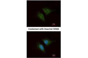 ICC/IF Image Immunofluorescence analysis of methanol-fixed HeLa, using Coronin 1C, antibody at 1:200 dilution. (CORO1C anticorps  (C-Term))