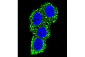 Confocal immunofluorescent analysis of CD28 Antibody (C-term) (ABIN390970 and ABIN2841150) with Hela cell followed by Alexa Fluor® 489-conjugated goat anti-rabbit lgG (green). (CD28 anticorps  (C-Term))