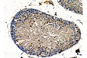 NCE2 Antibody at 1/100 staining mouse testis tissue by IHC-P.