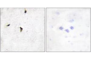 Immunohistochemistry analysis of paraffin-embedded human brain tissue, using Kv2. (Kv2.1/KCNB1 anticorps  (AA 533-582))