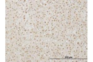 Image no. 1 for anti-LIM Homeobox 4 (LHX4) (AA 208-307) antibody (ABIN599314) (LHX4 anticorps  (AA 208-307))