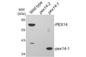Western Blotting (WB) image for anti-Peroxisomal Biogenesis Factor 14 (PEX14) (N-Term), (pHis6) antibody (ABIN5326727) (PEX14 anticorps  (N-Term, pHis6))