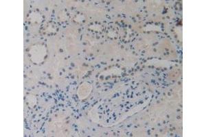 Detection of EBI3 in Human Kidney Tissue using Monoclonal Antibody to Epstein Barr Virus Induced Protein 3 (EBI3)