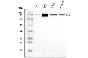 Western blot analysis of FXI/F11 using anti-FXI/F11 antibody (ABIN7602456).