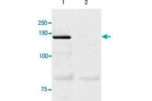 The tissue lysate derived from mouse lung was immunoprecipitated by NOS3 polyclonal antibody , then immuno-blotted by the same antibody at 1 : 500 (lane 1). (ENOS anticorps  (C-Term))