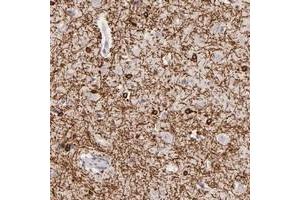 Immunohistochemical staining of human cerebral cortex with ZC3H7B polyclonal antibody  shows strong cytoplasmic positivity in glial cells at 1:50-1:200 dilution. (ZC3H7B anticorps)