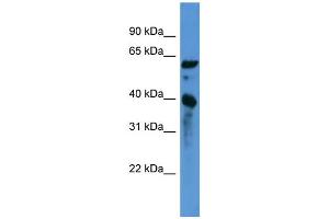 WB Suggested Anti-CNN3 Antibody Titration: 0. (CNN3 anticorps  (C-Term))