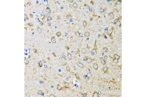 Immunohistochemistry of paraffin-embedded mouse brain using MAP1LC3B antibody. (LC3B anticorps)