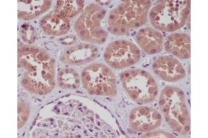 Immunohistochemical analysis of paraffin-embedded human kidney, using NF-κB p105/p50 Antibody.