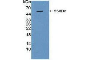 Detection of Recombinant PRKAb1, Human using Polyclonal Antibody to Protein Kinase, AMP Activated Beta 1 (PRKAb1)