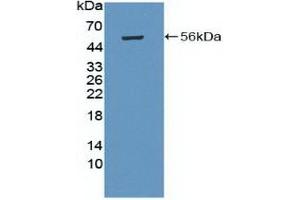 Detection of Recombinant PRKAb1, Human using Polyclonal Antibody to Protein Kinase, AMP Activated Beta 1 (PRKAb1) (PRKAB1 anticorps  (AA 13-242))