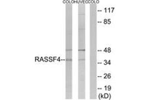 Western blot analysis of extracts from COLO/HuvEc cells, using RASSF4 Antibody. (RASSF4 anticorps  (AA 134-183))