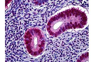 Anti-PGR / Progesterone Receptor antibody IHC of human uterus. (Progesterone Receptor anticorps)