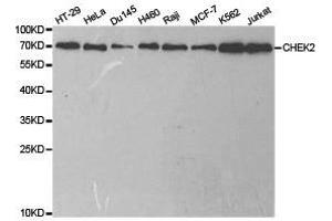 Western Blotting (WB) image for anti-Checkpoint Kinase 2 (CHEK2) antibody (ABIN1871829)
