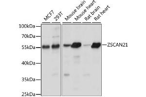 Western blot analysis of extracts of various cell lines, using ZSCAN21 antibody. (ZSCAN21 anticorps)