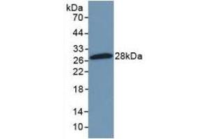 Detection of Recombinant NFkB2, Mouse using Polyclonal Antibody to Nuclear Factor Kappa B2 (NFkB2) (Nuclear Factor kappa B2 (AA 25-224) anticorps)