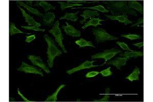 Immunofluorescence of monoclonal antibody to SGK2 on HeLa cell.