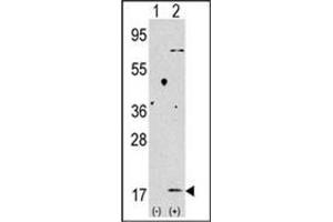 Western blot analysis of Autophagy LC3B Antibody (C-term) in 293 cell line lysates transiently transfected with the LC3 (APG8b) gene (2ug/lane).