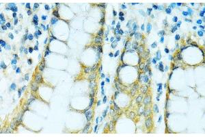 Immunohistochemistry of paraffin-embedded Human colon using CYP2B6 Polyclonal Antibody at dilution of 1:100 (40x lens).