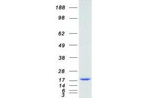 Validation with Western Blot