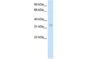 Human Muscle; WB Suggested Anti-HOXA2 Antibody Titration: 0. (HOXA2 anticorps  (Middle Region))