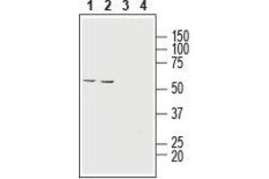 Western blot analysis of human HT-29 colon adenocarcinoma cell line lysate (lanes 1 and 3) and human ARPE-19 retinal pigment epithelium cell line lysate (lanes 2 and 4): - 1,2.