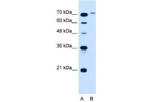 SLCO6A1 antibody used at 5 ug/ml to detect target protein.