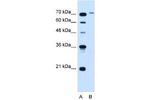 SLCO6A1 antibody used at 5 ug/ml to detect target protein. (SLCO6A1 anticorps  (N-Term))