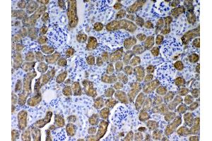 IHC analysis of PAH using anti-PAH antibody .