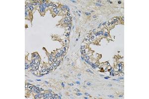 Immunohistochemistry of paraffin-embedded human prostate using EIF3H Antibody. (EIF3H anticorps)