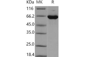 Western Blotting (WB) image for Mitogen-Activated Protein Kinase 1 (MAPK1) protein (GST tag,His tag) (ABIN7320277)