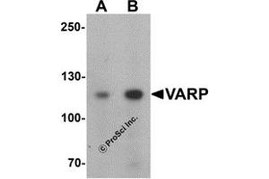 Western Blotting (WB) image for anti-Ankyrin Repeat Domain 27 (VPS9 Domain) (ANKRD27) (N-Term) antibody (ABIN1031656) (ANKRD27 anticorps  (N-Term))