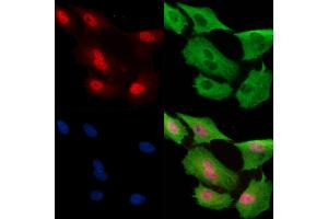 Phospho-Nanog (Thr280) Antibody staining A549 cells(H2O2 treatment) by IF/ICC. (Nanog anticorps  (pThr280))