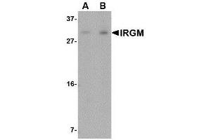 Image no. 1 for anti-Immunity-Related GTPase Family, M (IRGM) (N-Term) antibody (ABIN1494356) (IRGM anticorps  (N-Term))