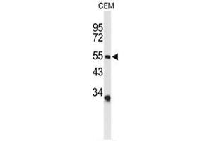 Western blot analysis of ACCN2 Antibody (C-term) in CEM cell line lysates (35 µg/lane). (ASIC1 anticorps  (C-Term))