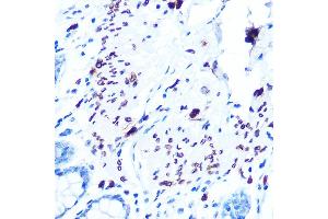 Immunohistochemistry of paraffin-embedded human colon using Emerin/EMD Rabbit mAb (ABIN7266933) at dilution of 1:100 (40x lens). (Emerin anticorps)