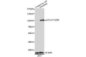 Western blot analysis of extracts of 293T cells, using Phospho-FoxO1-S256 antibody (ABIN5969947) at 1/1000 dilution. (FOXO1 anticorps  (pSer256))