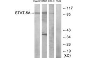 Western Blotting (WB) image for anti-Signal Transducer and Activator of Transcription 5A (STAT5A) (AA 666-715) antibody (ABIN2889069) (STAT5A anticorps  (AA 666-715))