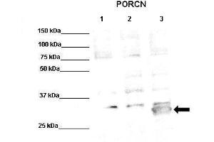 WB Suggested Anti-PORCN Antibody  Positive Control: Lane1: 50ug PORCN-KO HT1080 (microsomes), Lane2: 50ug HT1080 (microsomes), Lane3: 50ug PORCN transfected HT1080 (microsomes)  Primary Antibody Dilution :  1:500 Secondary Antibody :  Anti-rabbit-HRP  Secondry Antibody Dilution :  1:10,000 Submitted by: Anonymous