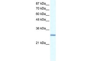 Human Daudi; WB Suggested Anti-GTF2E2 Antibody Titration: 0. (GTF2E2 anticorps  (N-Term))