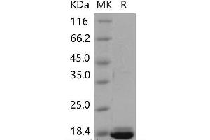 Western Blotting (WB) image for Peroxiredoxin 5 (PRDX5) (Active) protein (His tag) (ABIN7320236) (Peroxiredoxin 5 Protein (PRDX5) (His tag))
