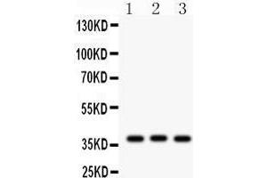Western Blotting (WB) image for anti-Connective Tissue Growth Factor (CTGF) (AA 58-349) antibody (ABIN3042771) (CTGF anticorps  (AA 58-349))